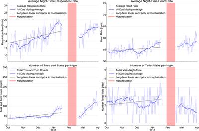 Case Report: Ambient Sensor Signals as Digital Biomarkers for Early Signs of Heart Failure Decompensation